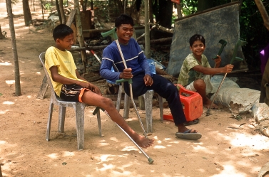 Landminenopfer in Siam Reap, Kambodscha